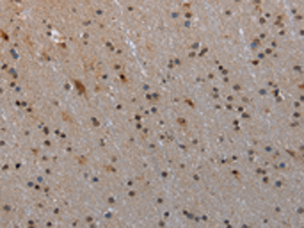 Anti-MTSS1 Rabbit Polyclonal Antibody