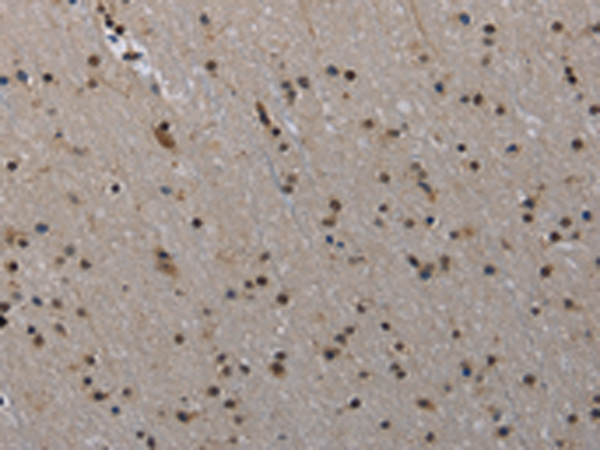 Anti-MVD Rabbit Polyclonal Antibody