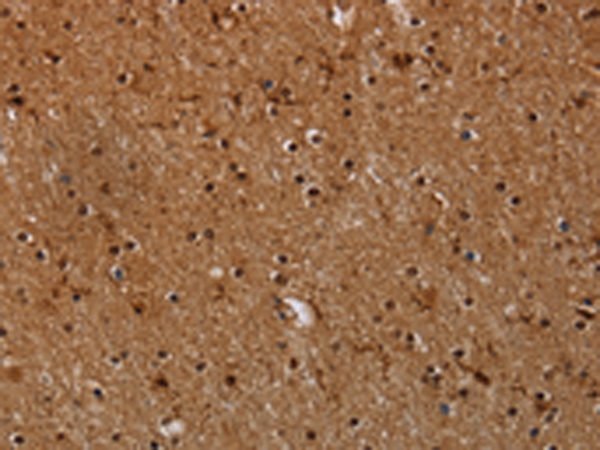 Anti-MYBBP1A Rabbit Polyclonal Antibody
