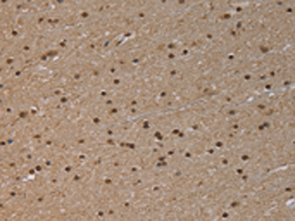 Anti-NLRP6 Rabbit Polyclonal Antibody