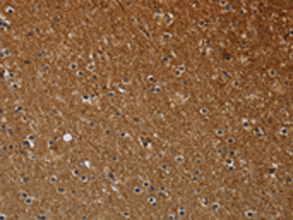 Anti-NCKAP1 Rabbit Polyclonal Antibody