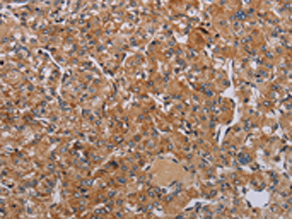 Anti-NDUFA8 Rabbit Polyclonal Antibody