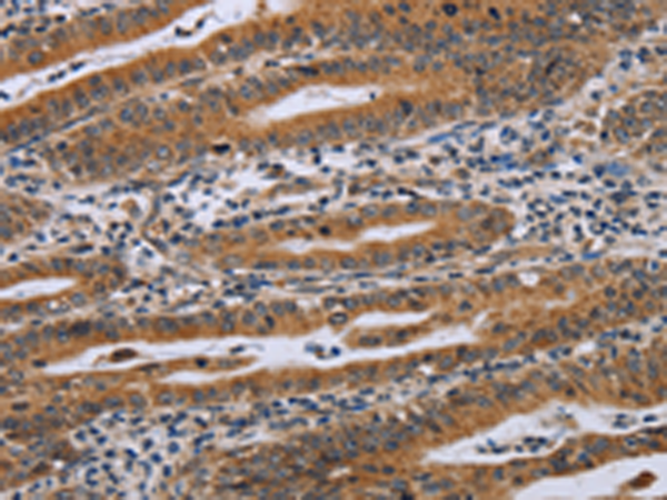 Anti-NDUFAF4 Rabbit Polyclonal Antibody