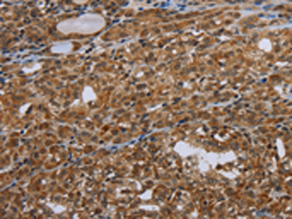 Anti-NIRF Rabbit Polyclonal Antibody