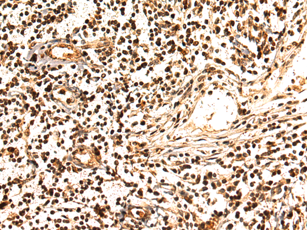 Anti-n Myc Rabbit Polyclonal Antibody