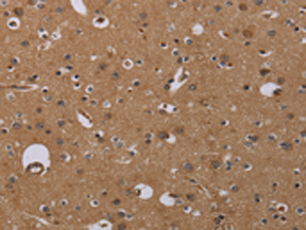 Anti-NPRL2 Rabbit Polyclonal Antibody