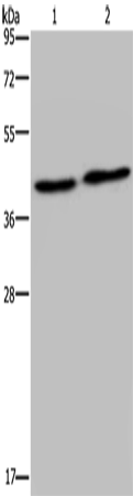 Anti-NPRL2 Rabbit Polyclonal Antibody