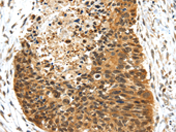 Anti-NR2F2 Rabbit Polyclonal Antibody