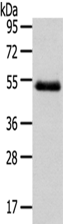 Anti-NR2F2 Rabbit Polyclonal Antibody