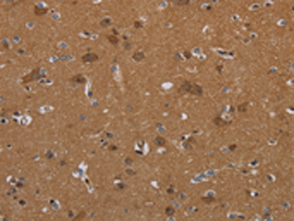 Anti-SLC22A2 Rabbit Polyclonal Antibody