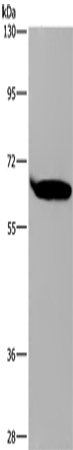 Anti-SLC22A2 Rabbit Polyclonal Antibody