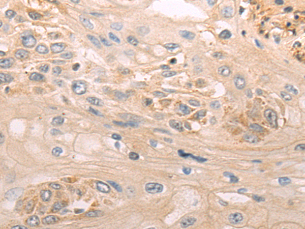 Anti-OSM Rabbit Polyclonal Antibody