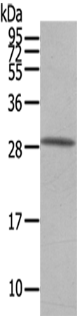 Anti-OSM Rabbit Polyclonal Antibody