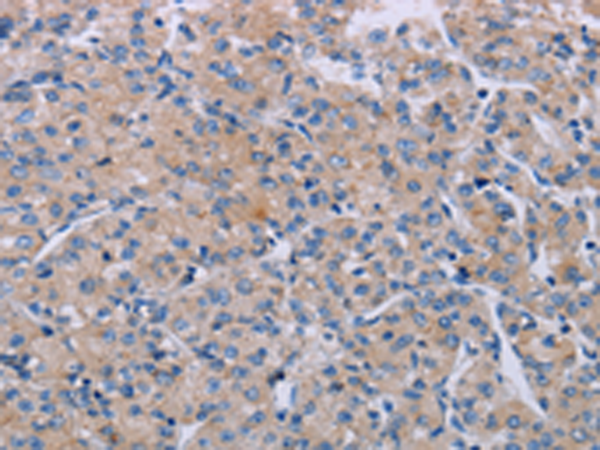 Anti-P2RX3 Rabbit Polyclonal Antibody