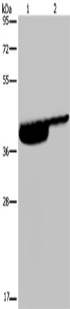 Anti-P2RX3 Rabbit Polyclonal Antibody