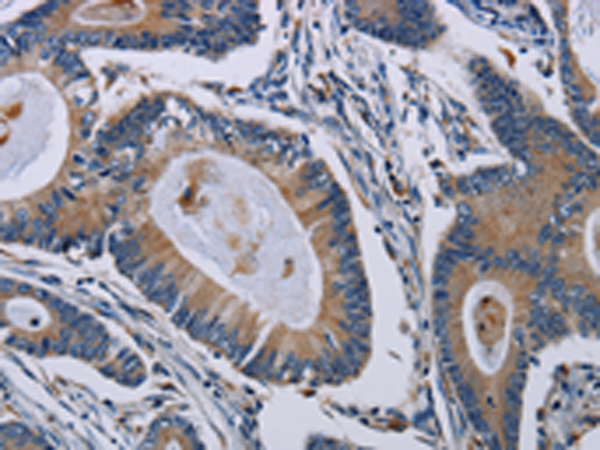 Anti-PCDHAC1 Rabbit Polyclonal Antibody