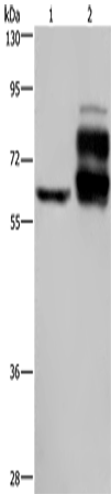 Anti-PCSK9 Rabbit Polyclonal Antibody