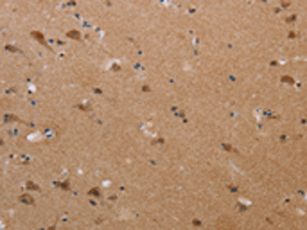 Anti-Plexin A4 Rabbit Polyclonal Antibody