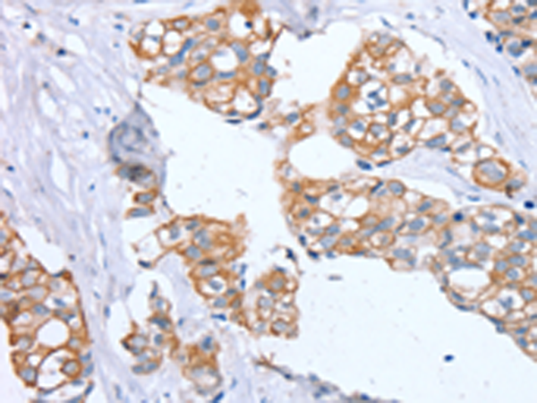 Anti-PTP4A2 Rabbit Polyclonal Antibody