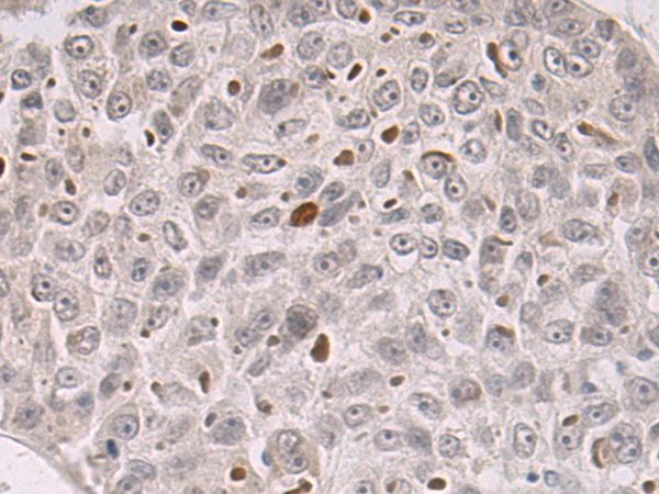 Anti-CENPV Rabbit Polyclonal Antibody