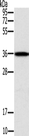 Anti-CENPV Rabbit Polyclonal Antibody