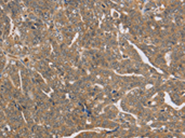 Anti-PTPN12 Rabbit Polyclonal Antibody