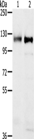 Anti-PTPN12 Rabbit Polyclonal Antibody