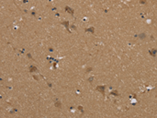Anti-PUS10 Rabbit Polyclonal Antibody