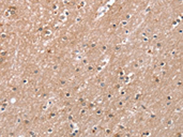 Anti-Rab8A Rabbit Polyclonal Antibody