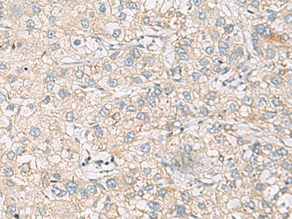 Anti-Rac2 Rabbit Polyclonal Antibody