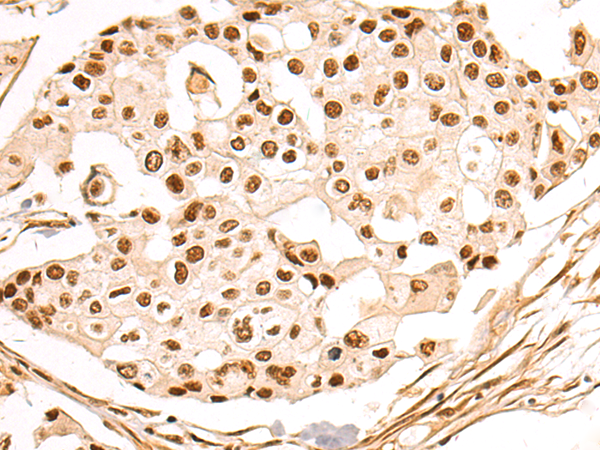 Anti-ZMIZ1 Rabbit Polyclonal Antibody