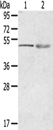 Anti-RHCE Rabbit Polyclonal Antibody