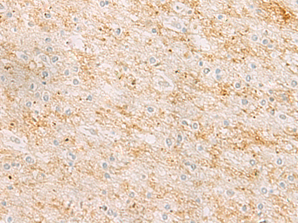 Anti-RHCG Rabbit Polyclonal Antibody