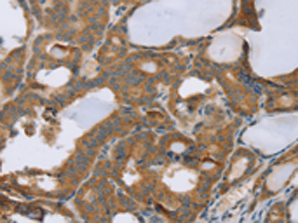 Anti-SLC39A7 Rabbit Polyclonal Antibody