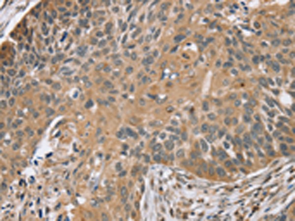 Anti-TRIM3 Rabbit Polyclonal Antibody