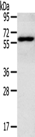 Anti-RORA Rabbit Polyclonal Antibody