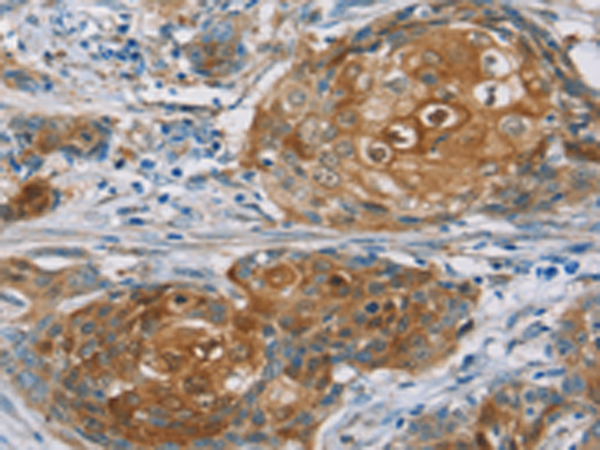 Anti-RORB Rabbit Polyclonal Antibody