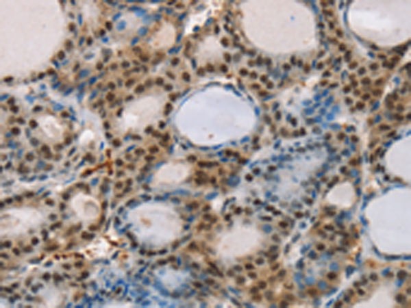 Anti-RUNX1T1 Rabbit Polyclonal Antibody