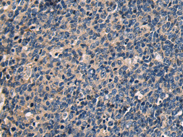 Anti-SAMD9L Rabbit Polyclonal Antibody