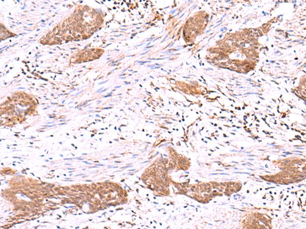 Anti-SASH1 Rabbit Polyclonal Antibody