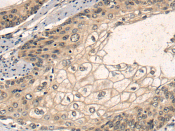 Anti-SCD1 Rabbit Polyclonal Antibody