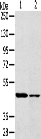 Anti-SCD1 Rabbit Polyclonal Antibody