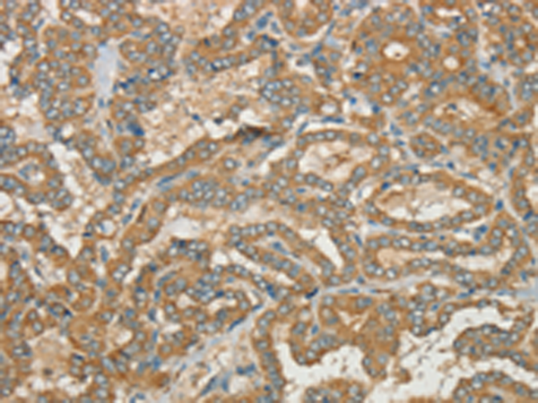Anti-CWC27 Rabbit Polyclonal Antibody