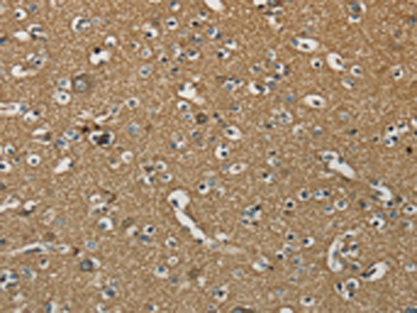 Anti-NEMF Rabbit Polyclonal Antibody