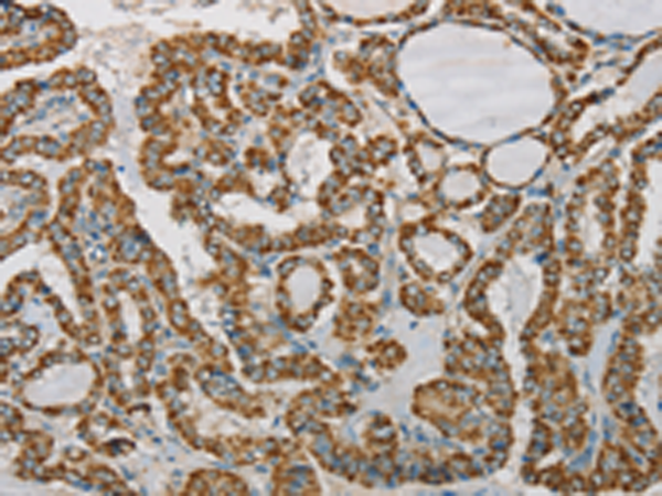 Anti-SDHB Rabbit Polyclonal Antibody