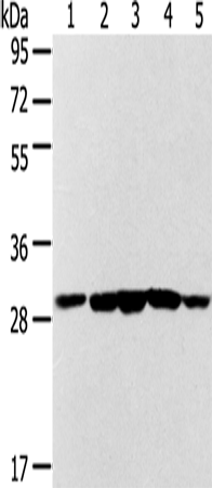 Anti-SDHB Rabbit Polyclonal Antibody