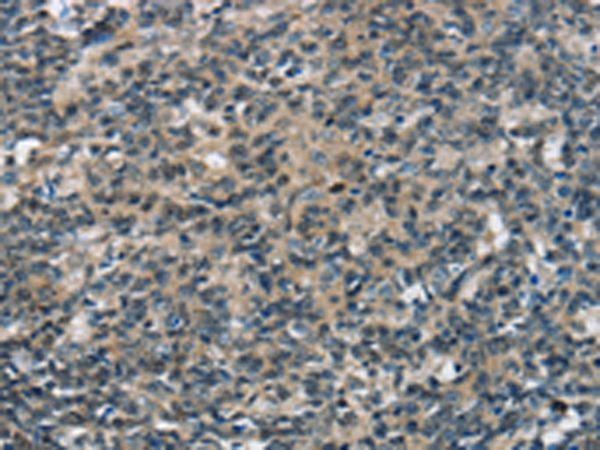 Anti-SEPN1 Rabbit Polyclonal Antibody