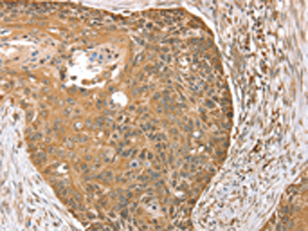 Anti-MORF4L1 Rabbit Polyclonal Antibody