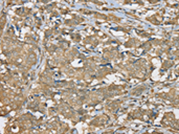 Anti-SERPINA11 Rabbit Polyclonal Antibody