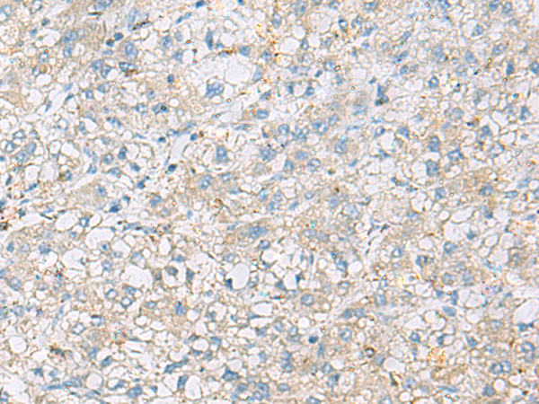 Anti-SIGLEC8 Rabbit Polyclonal Antibody